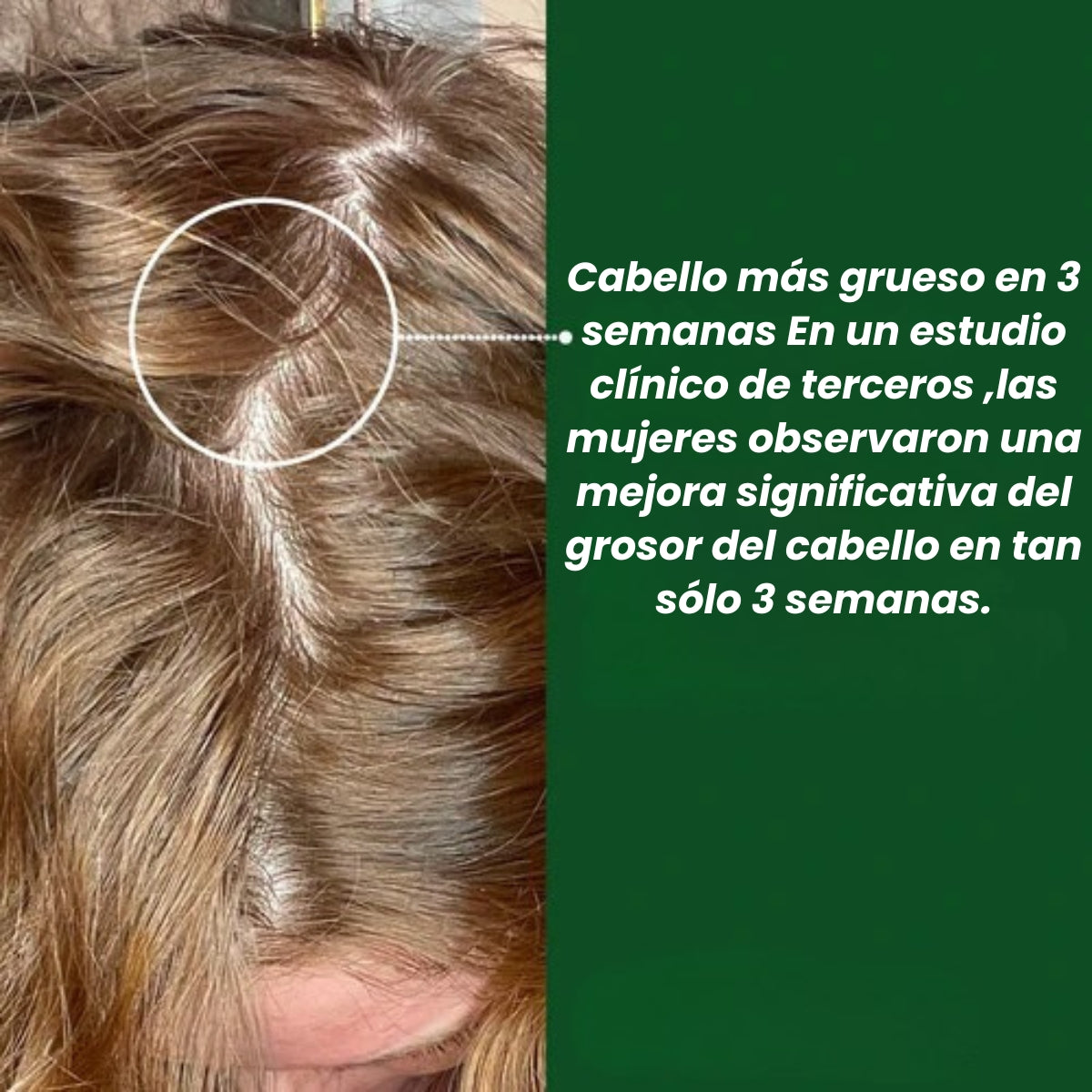 WILLO Cápsulas para el crecimiento del cabello