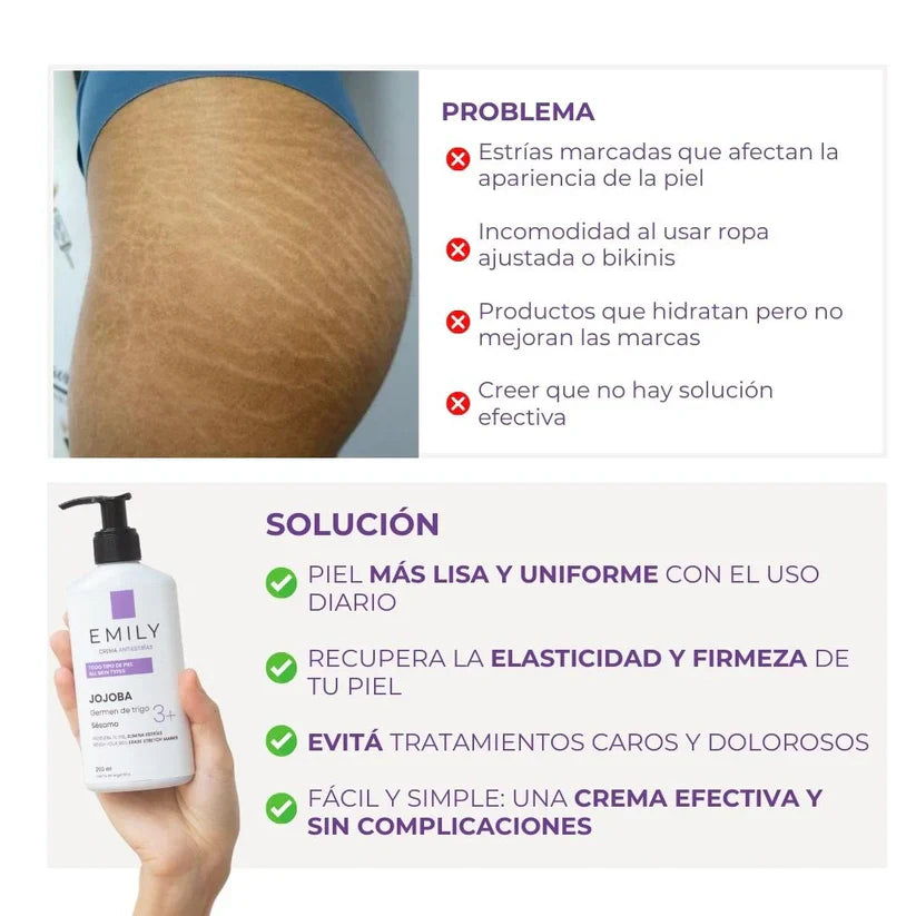 Crema AntiEstrías - 200ml EMILY
