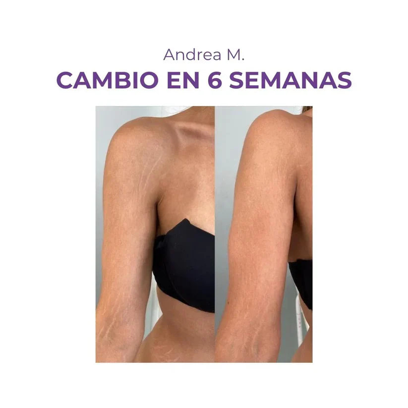 Crema AntiEstrías - 200ml EMILY