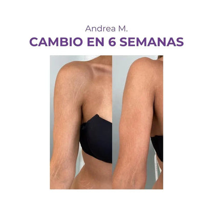 Crema AntiEstrías - 200ml EMILY